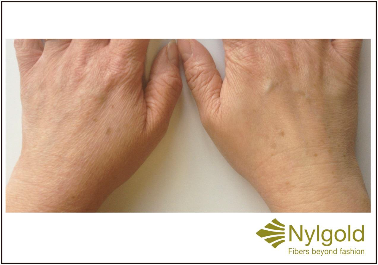 In contrast to ordinary cosmetics, Nylstar says, Nylgold acts directly on the skin cells, stimulating its own Hyaluronic Acid production and achieving moisturizing, firming and anti-oxidant properties that can vary depending on the fabric construction and composition.