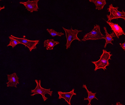 Yoga for connective tissue cells: In the presence of functionalized cellulose, connective tissue cells, as hoped, attach themselves more effectively and spread on the surface. Image: Empa.