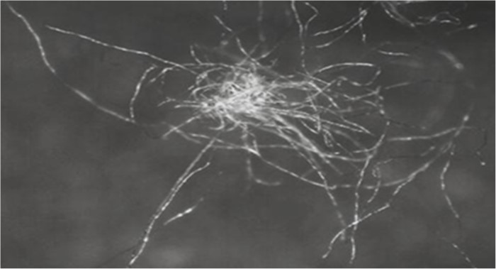 Neps (microscopic view). © Uster.