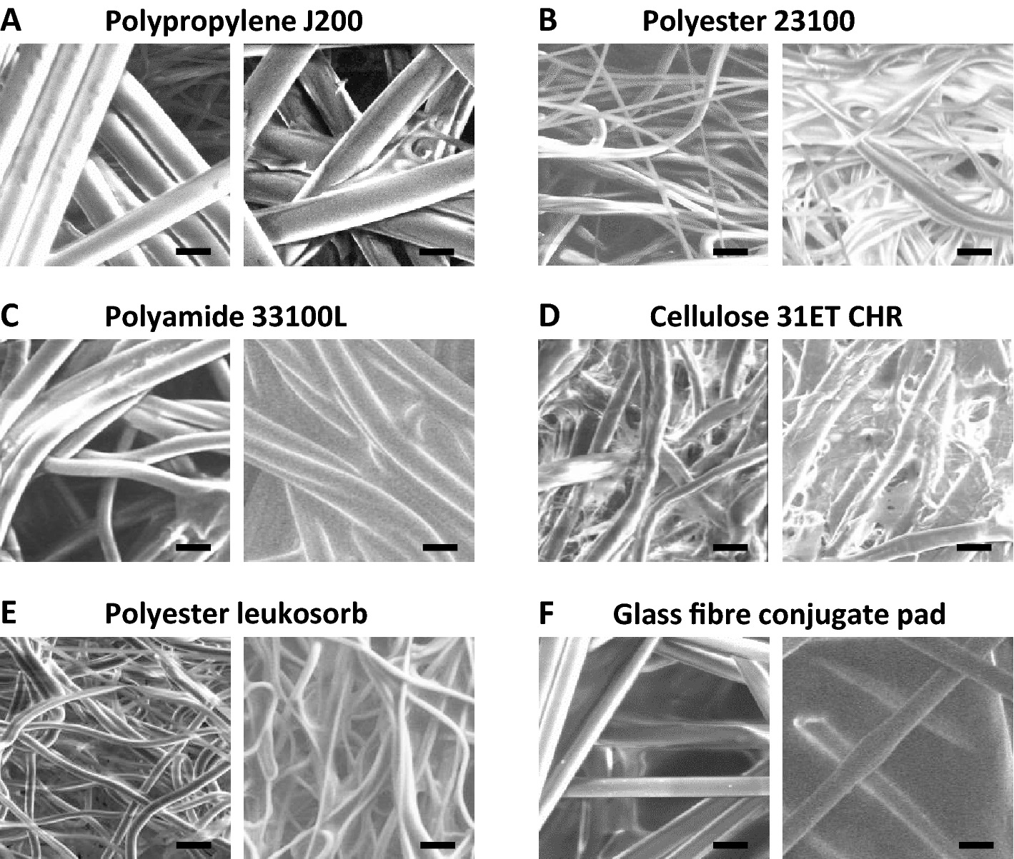 The physical appearance of fibres and sugar glass formed in nonwoven matrices. Scanning electron microscopy images of six different matrices at × 1,000 magnification. Within each panel, the left-hand image shows empty matrices and the right-hand image shows fibres after loading and drying of 0.5 M (80:20) trehalose:sucrose solution. Scale bar shows 20 µm in each image. ©  Vax-Hub 