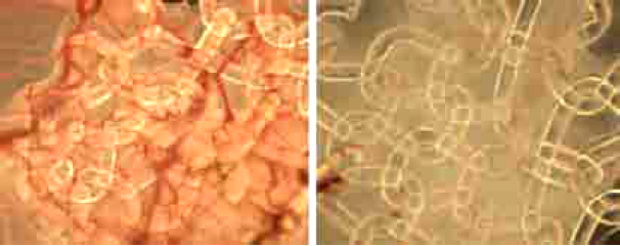 Left: Targeted new formation of blood vessels in a textile implant colonised by stem cells. The dense capillary network is clearly visible. Right: Negative check: Implant colonised with connective tissue cells, with no formation of new vessels. ©Hohenstein Institute