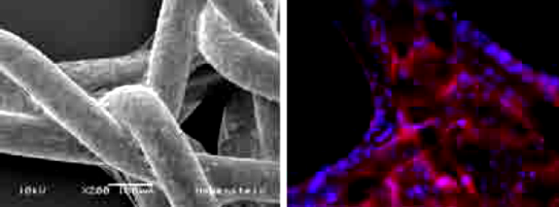 Human stem cells, colonising a textile implant. Detailed view through a scanning electron microscope (left), view through a fluorescence microscope (right). ©Hohenstein Institute