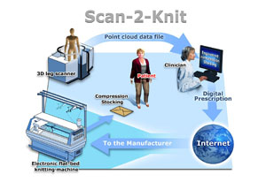 Scan-2-Knit technology for the treatment of lymphoedema treatment